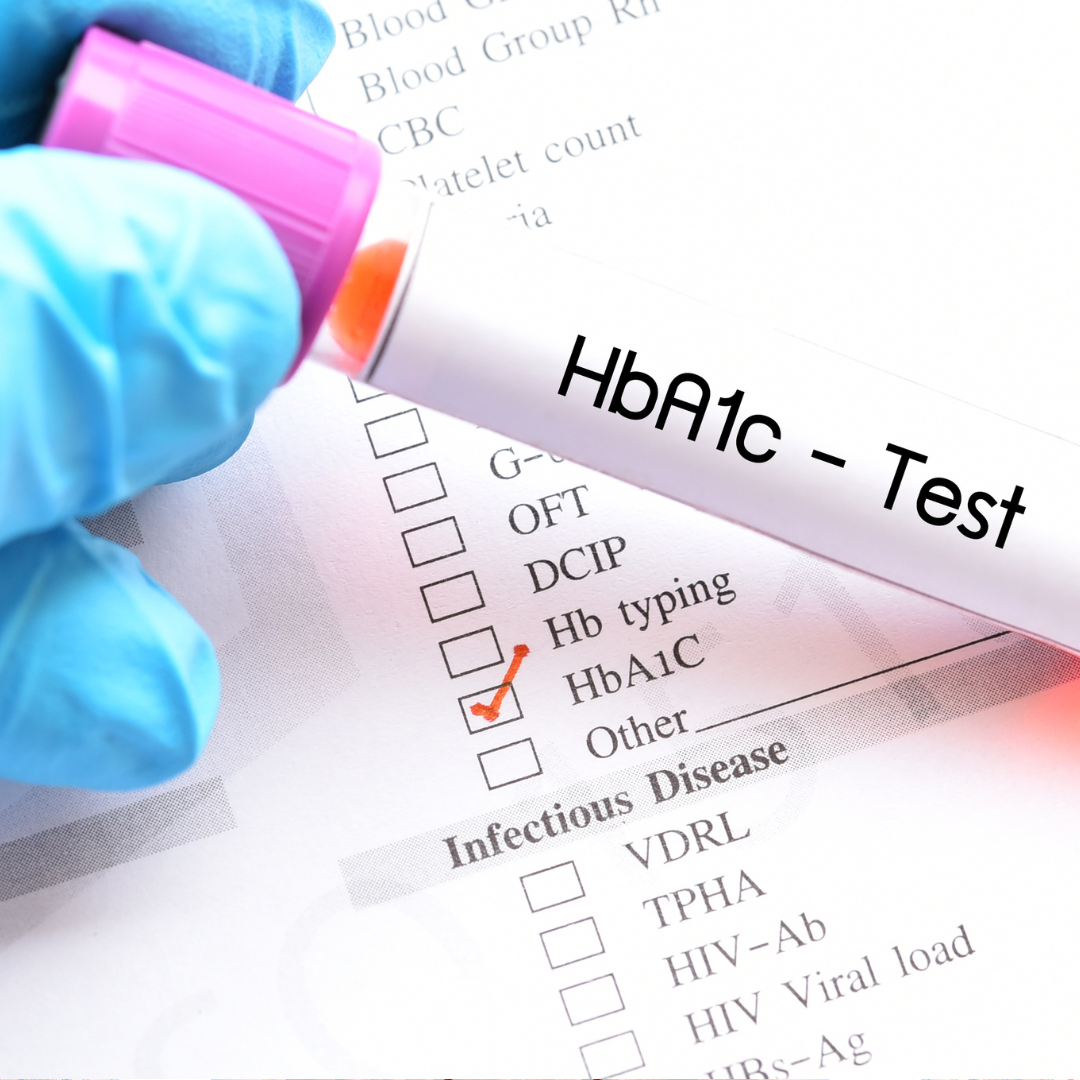 How often should I test for HbA1c?