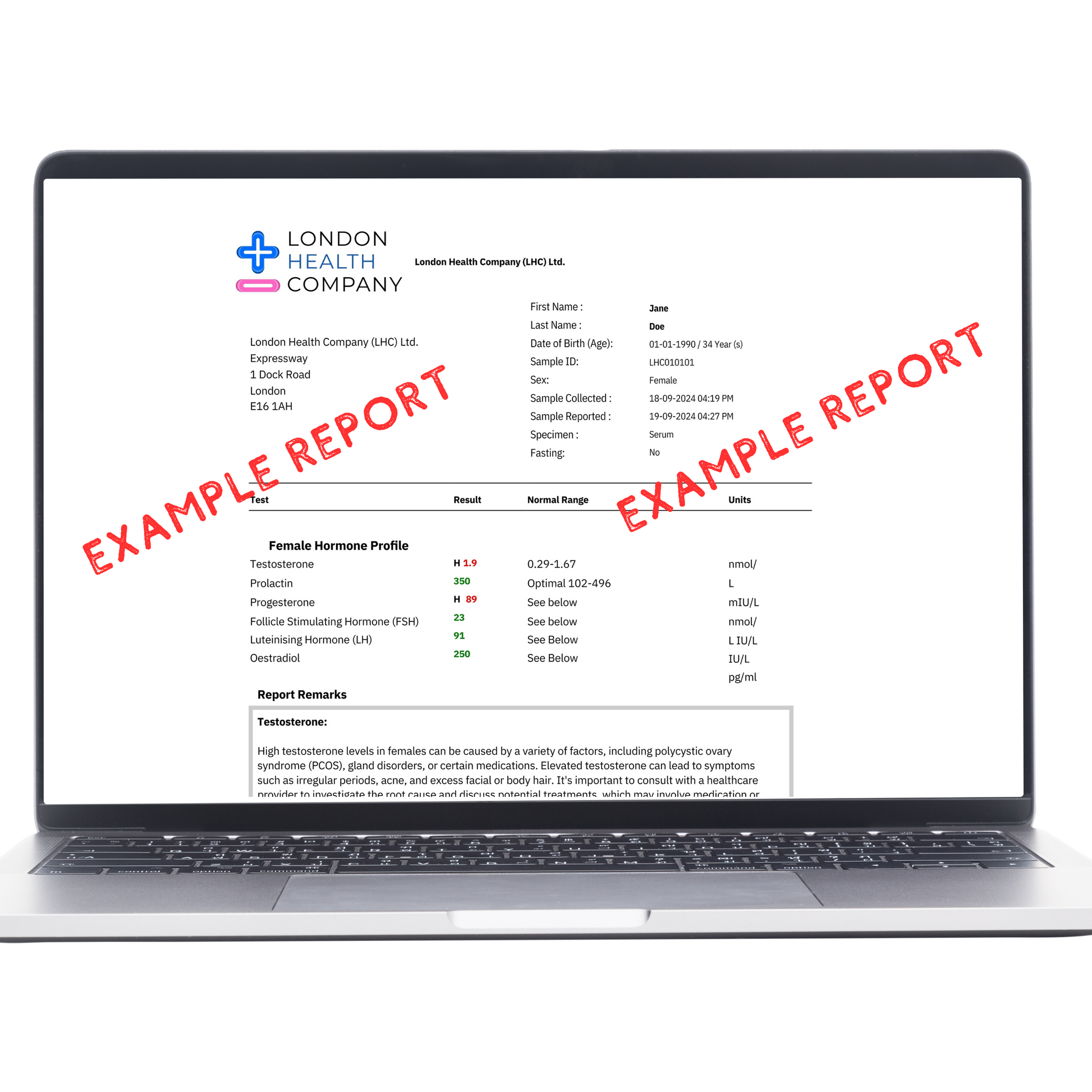 TSH Thyroid blood test quantitative result report