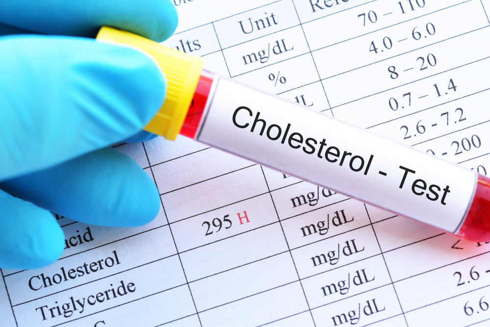 Why test for cholesterol? - London Health Company