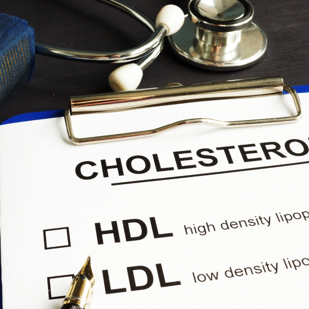 Hdl Union HDL Cholesterol