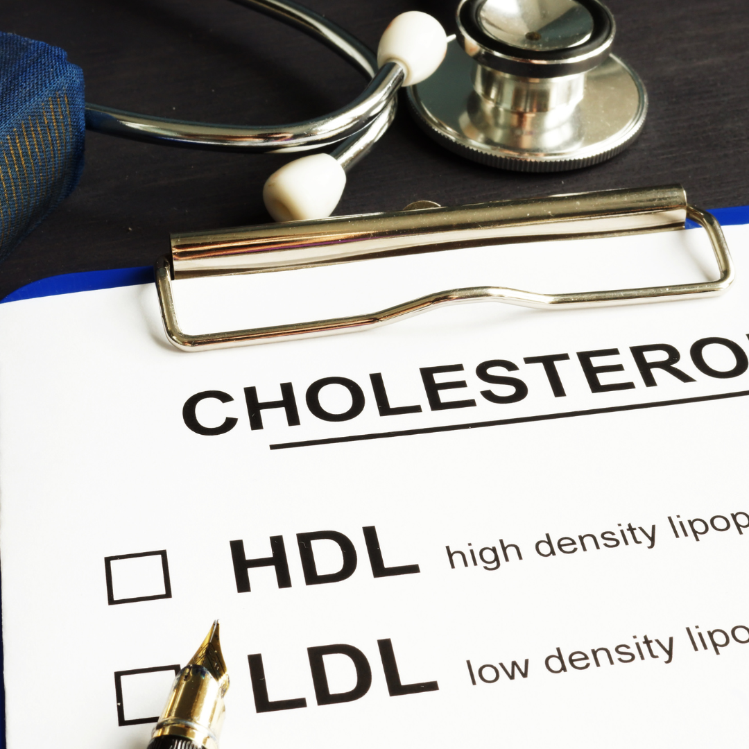 HDL Cholesterol