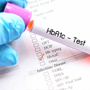 How often should I test for HbA1c?