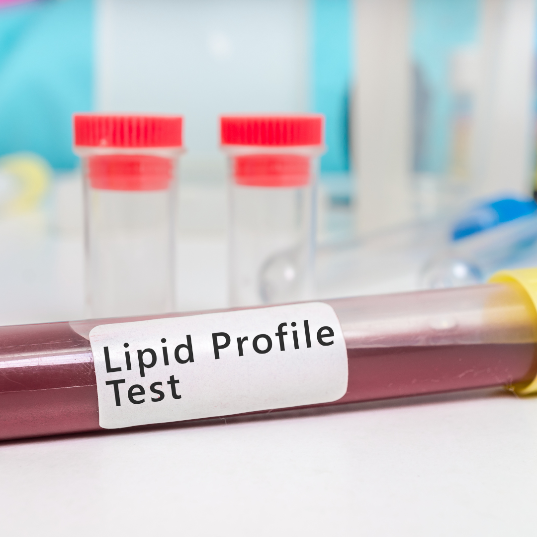 Understanding Your Lipid Profile Results