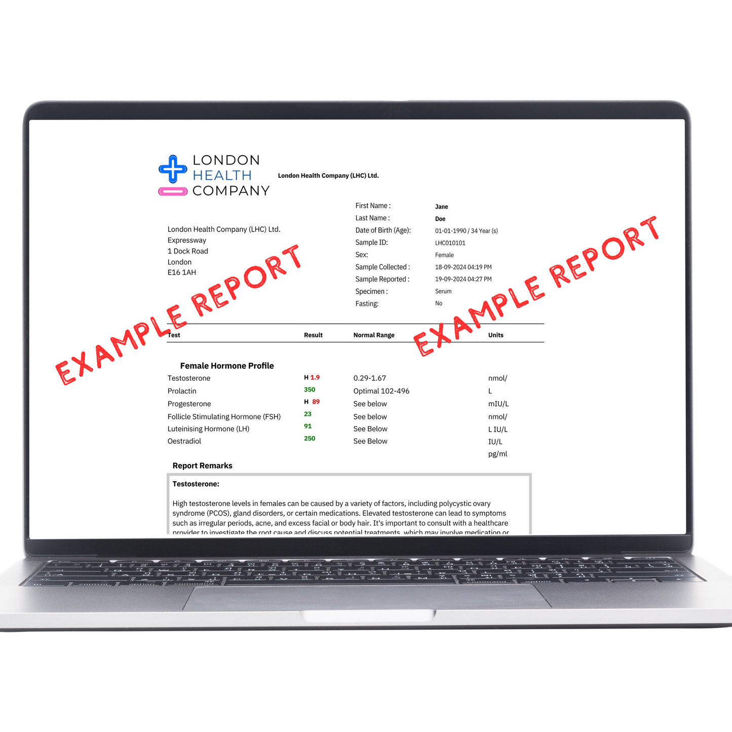 Electrolytes quantitative blood test result report