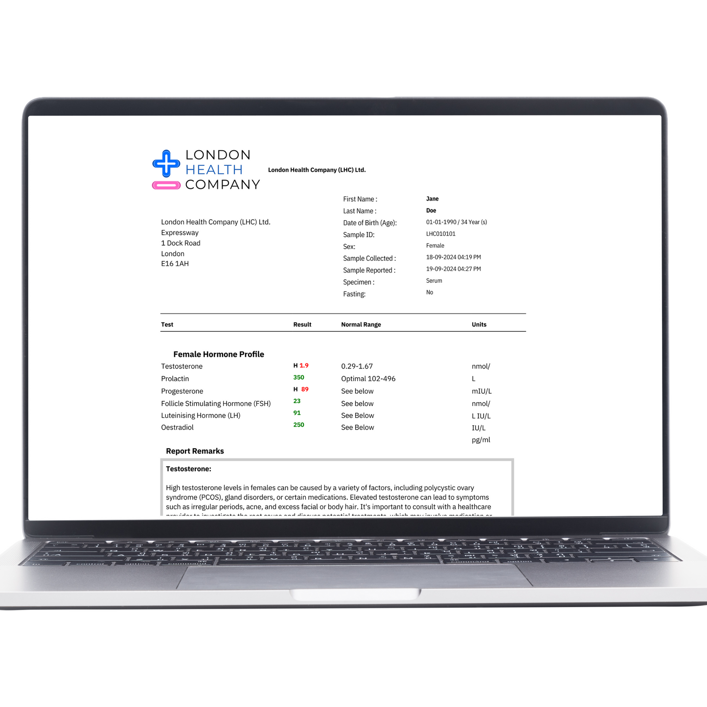 home blood test kit female hormone quantitative result report